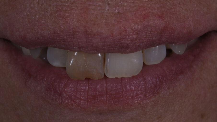 Fig. 1