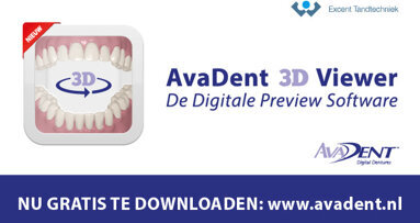 AvaDent 3D Viewer: Digitale Preview Software
