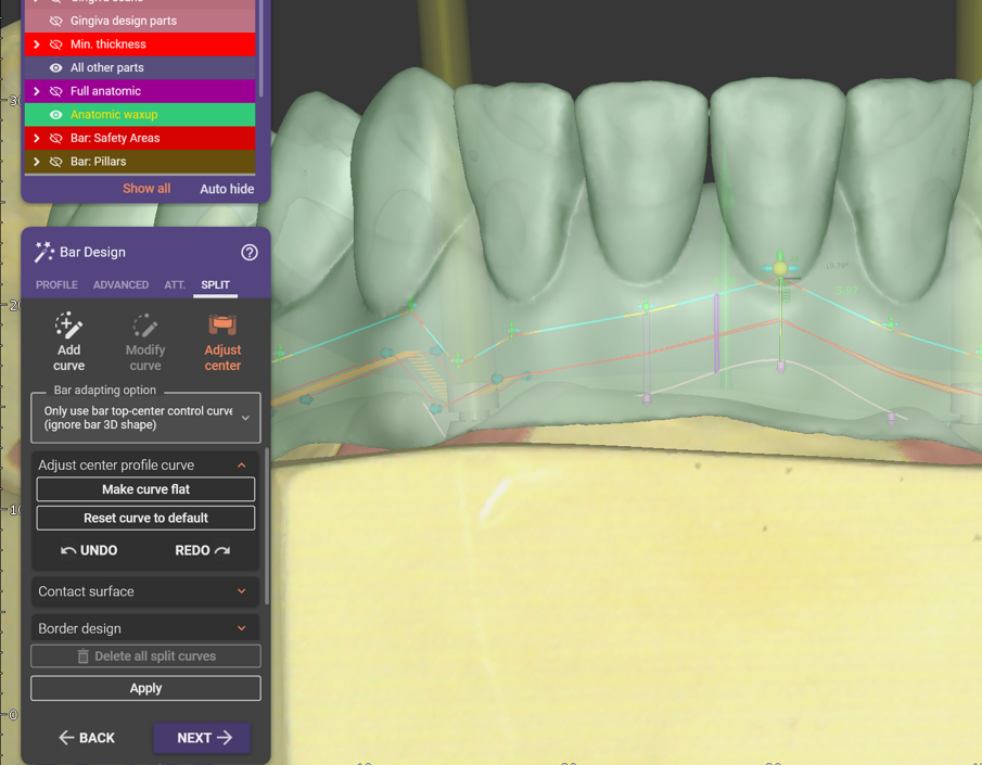 Fig. 2: “Split” tab with different options to adjust the bar.