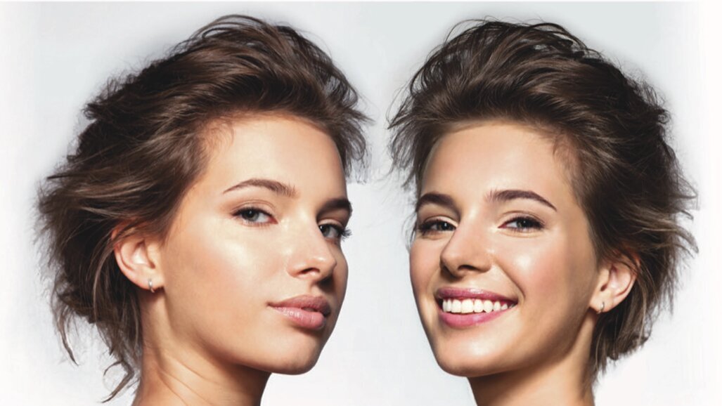 GC Smile Sculpting : petits changements, grands sourires