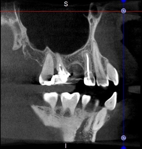 Fig. 30