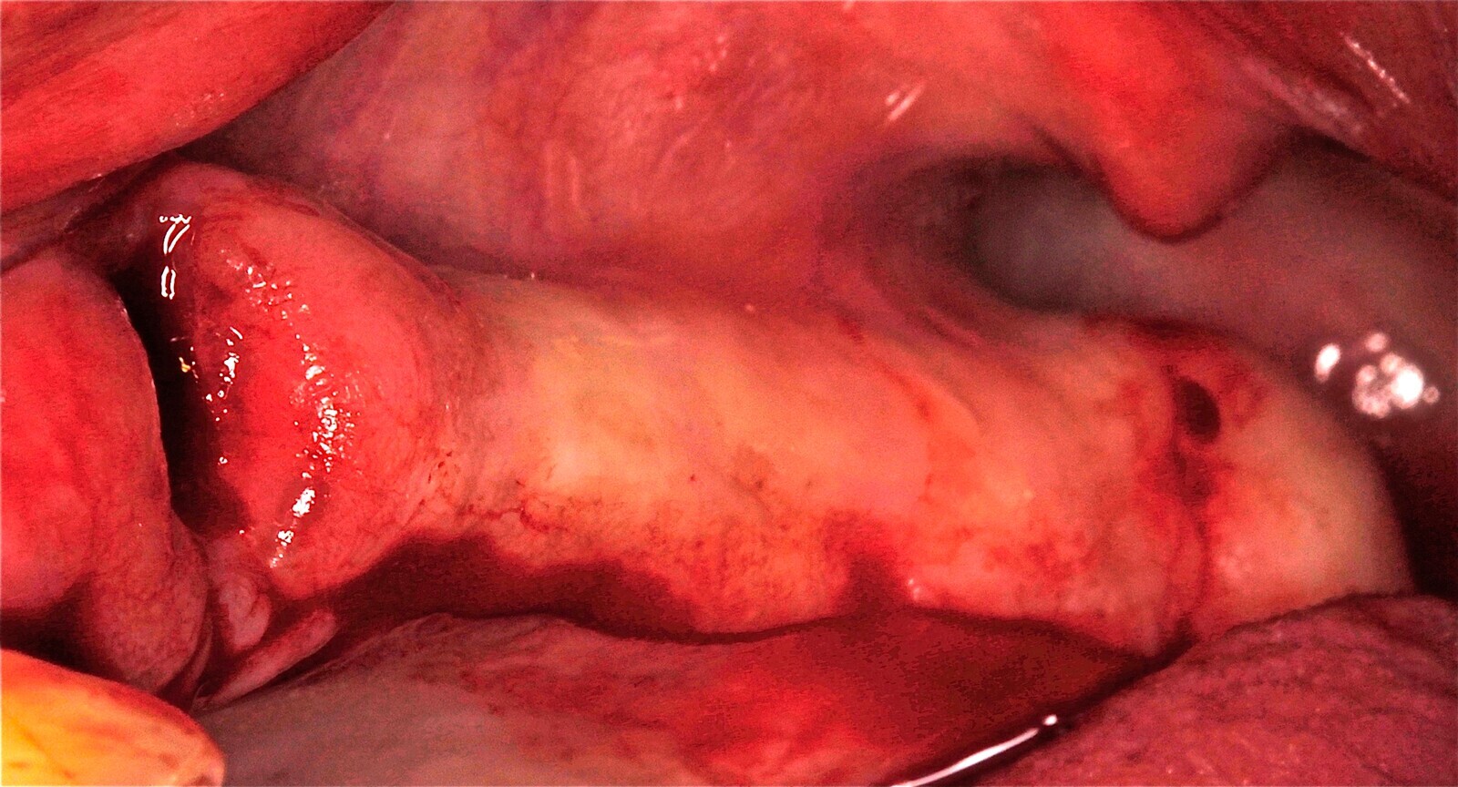 Fig. 13