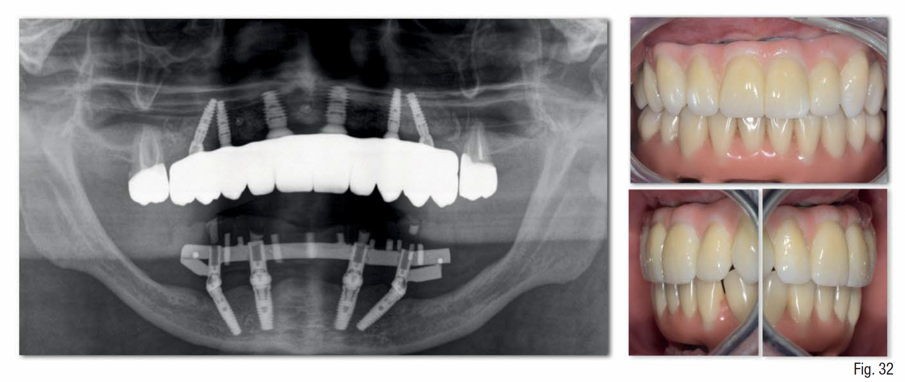 Fig. 32