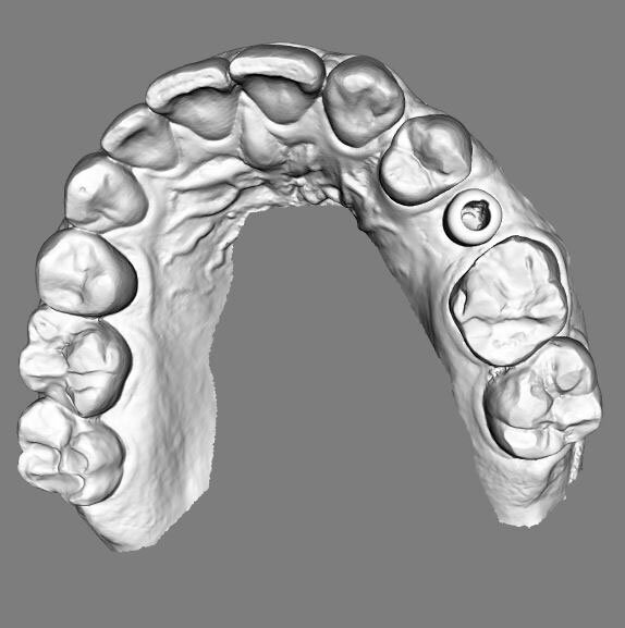 Fig. 14