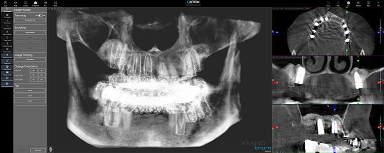 Fig. 12