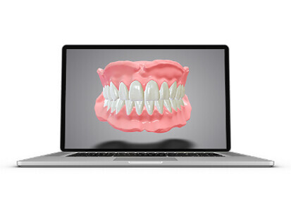 Dental Wings – DWOS Full Dentures