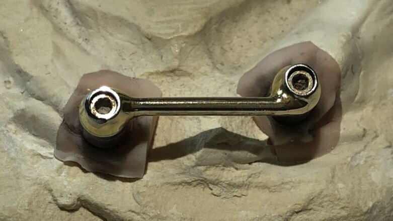 Modificatie van de dolderstaafconstructie