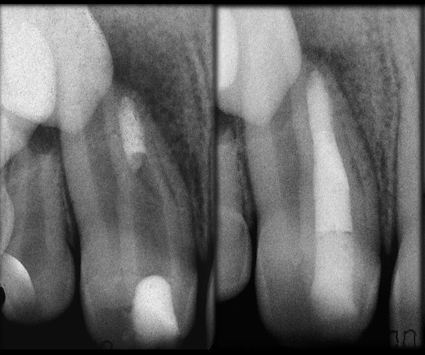 Fig. 36