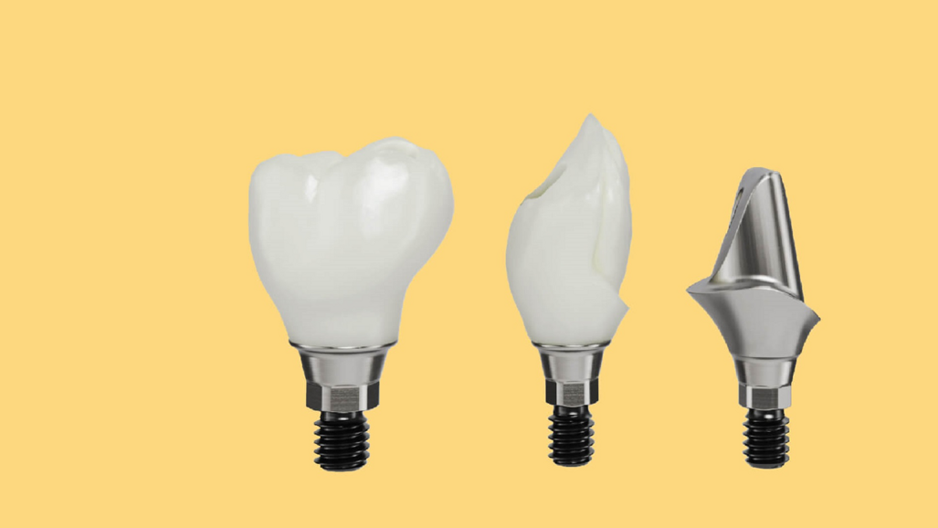 CAD/CAM NobelProcera: “It is a very stable and well-tested solution for us”