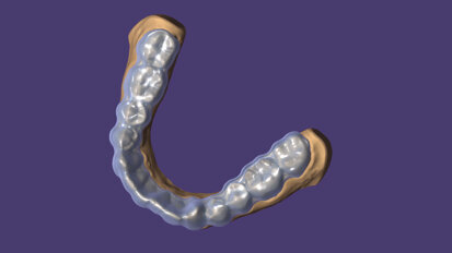 Exocad DentalCAD 3.2 Elefsina update includes more than 60 new features