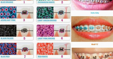La Ortodoncia: ¿salud o moda?