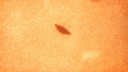 ‘Mondbacterie kan tandplakvorming remmen’