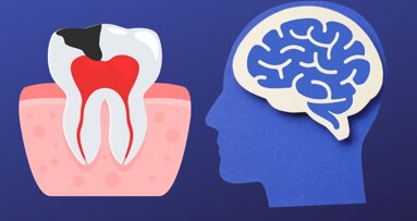 Impact of early childhood caries on mental development ​