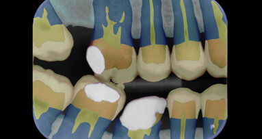 University spin-out raises funds for AI-driven dental diagnostics tool