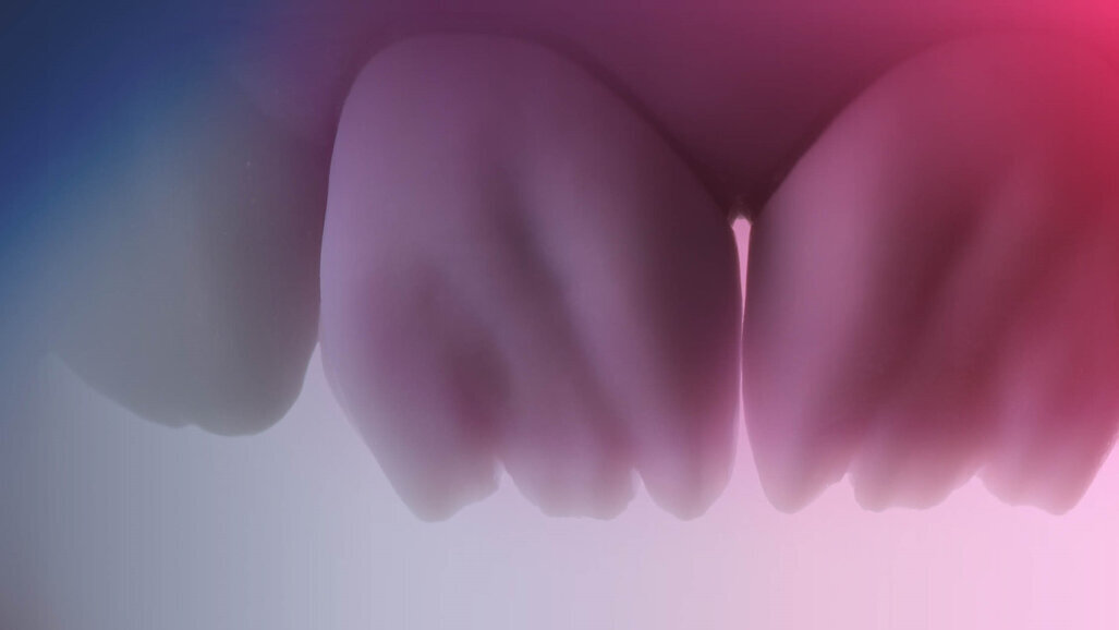 CERABIEN MiLai: Practical chroma map catalogue simplifies anterior restorations