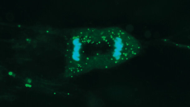 Ricerca ed evoluzione per le tecniche di riabilitazione implantoprotesica