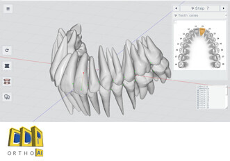 Polorto – DDP-AI