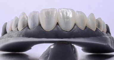 3D printing moves closer to definitive restorations