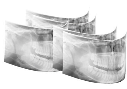 Orthopantomograph OP300