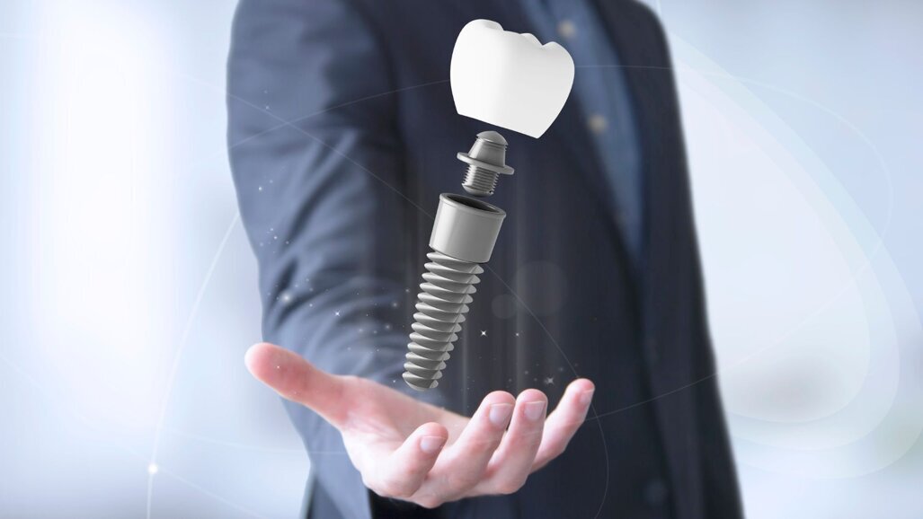 AI-powered AR systems will revolutionize implantology