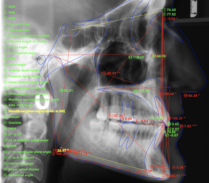 Fig. 35 