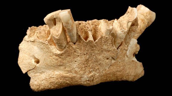 Placa dental antiga revela hábitos da espécie humana