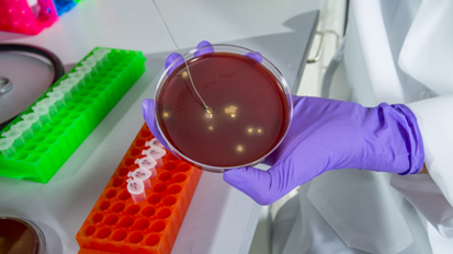 El uso de cadenas desechables de baberos elimina el riesgo de transmisión de bacterias