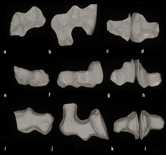 Figs. 24a–l: Virtual restorations from the occlusal view (a–d), buccal view (e–h) and intaglio view (i–l).