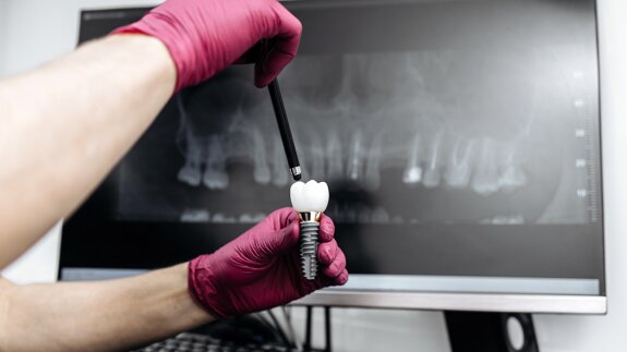 Treating complex implant cases: ITI webinar to cover treatment planning