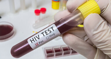 Facts statt Fakes: ZFA wissen über HIV in der Zahnarztpraxis Bescheid