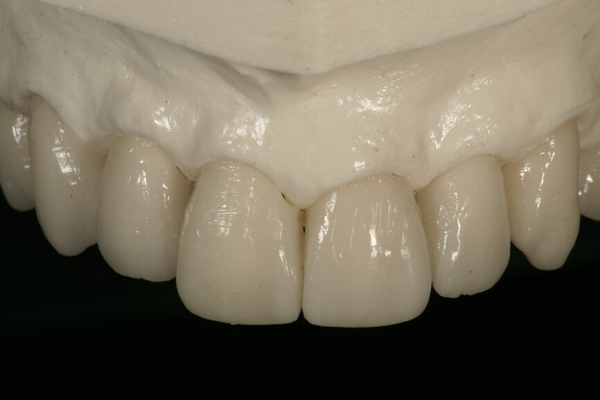 Fig. 10