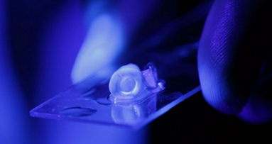 New research may revolutionize root canal treatment