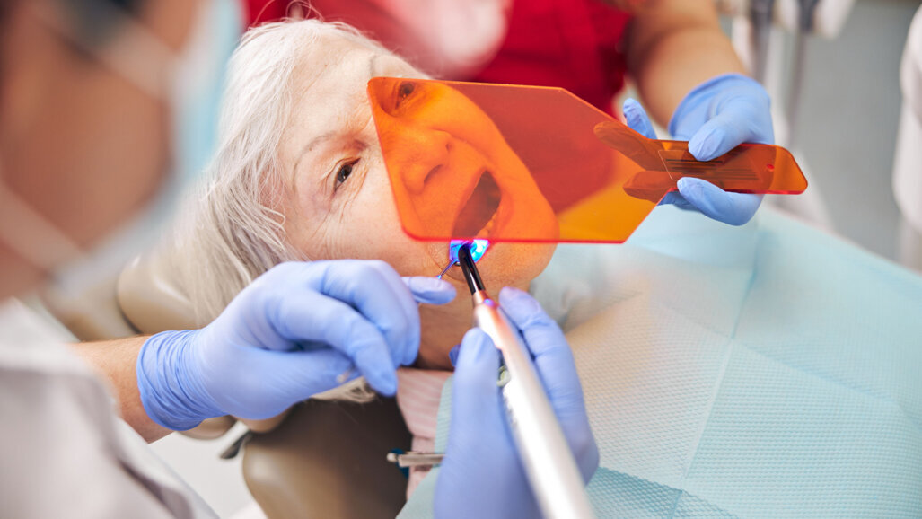 Global dental composite market expected to grow