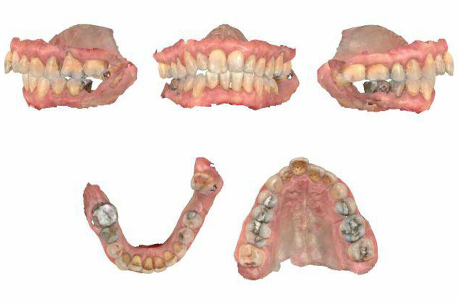 Fig. 4: Intra-oral scans.