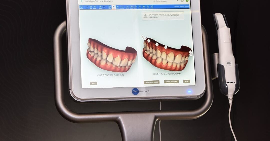 Do analógico ao digital – Align Technology lança o novo scanner iTero ...