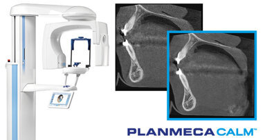 Imagistică excelentă cu unitățile CBCT de la Planmeca