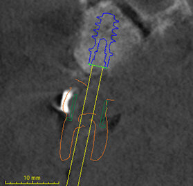 Fig. 38