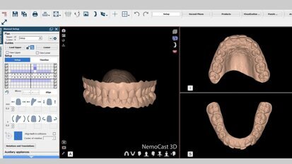 La planificación digital de la Ortodoncia en el Máster de USC