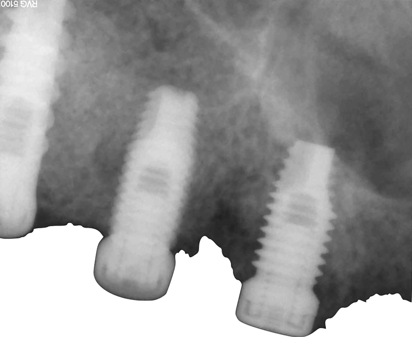 Fig. 9