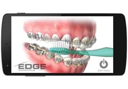 Why you matter: Edge Animations app helps explain it to patients