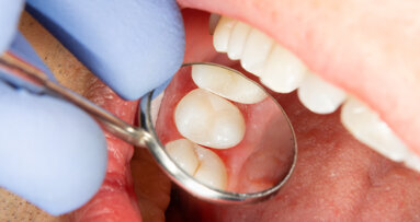 Transforming dentistry:&nbsp;Direct restoration procedures simplified