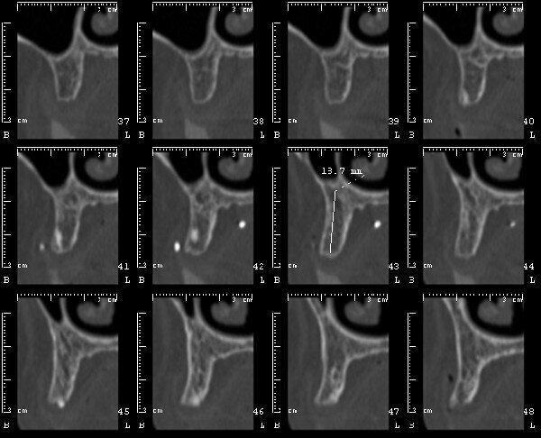 Fig. 12