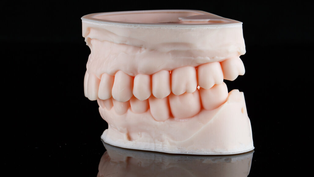 3D-printing acquisition may help Align Technology to break the mould