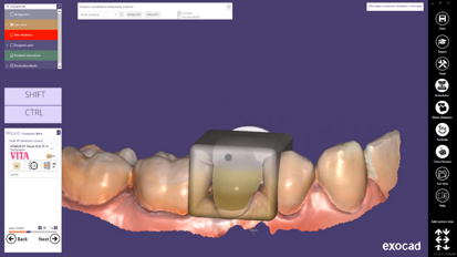 exocad Quick Guide: Learn more about the main indication of single-visit dentistry
