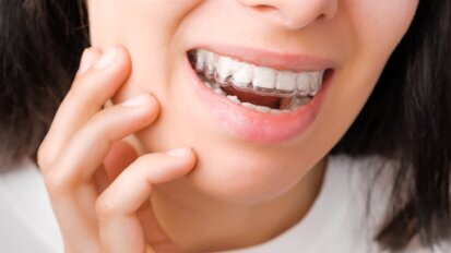 Allineatori trasparenti: uno studio esamina la perdita di ancoraggio durante la distalizzazione dei molari mascellari