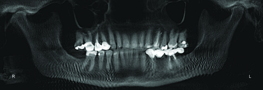 During treatment