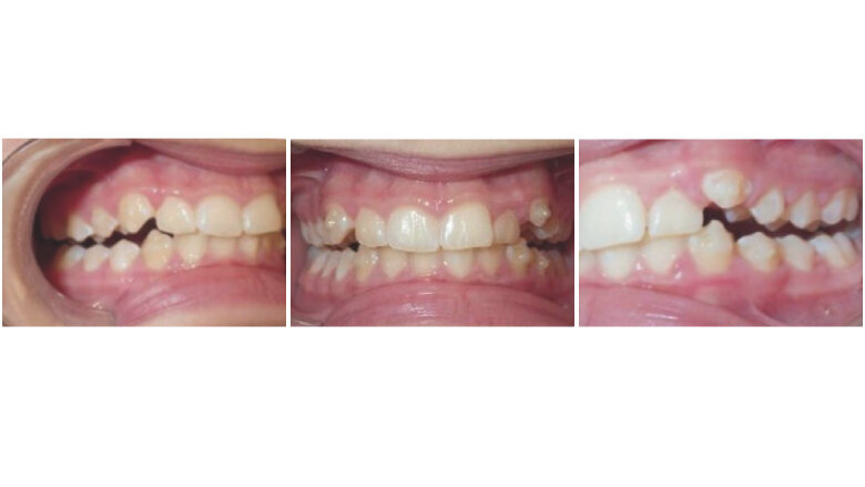 Progress after 3 months