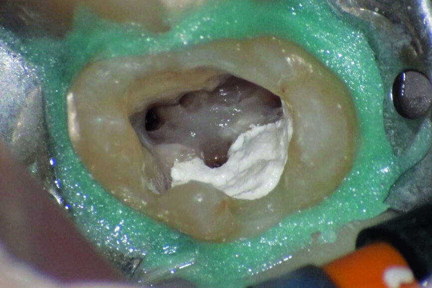 Figure 18