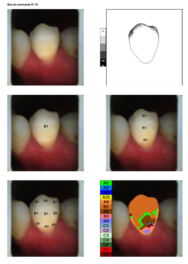 Figs. 7a,b,c,d,e,f