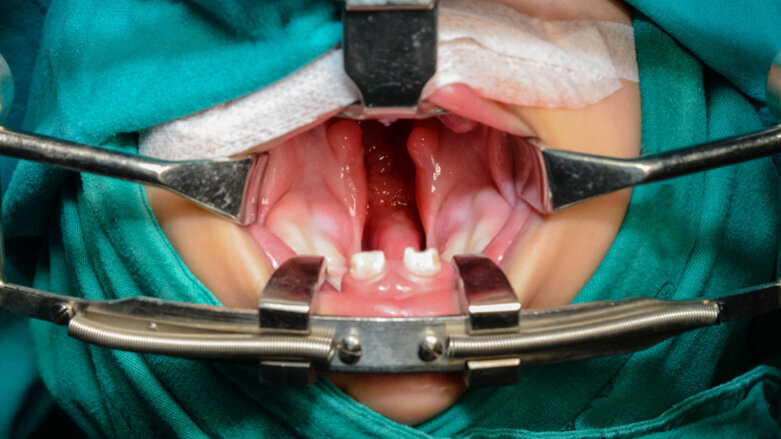 USC researchers seek to understand craniofacial abnormalities